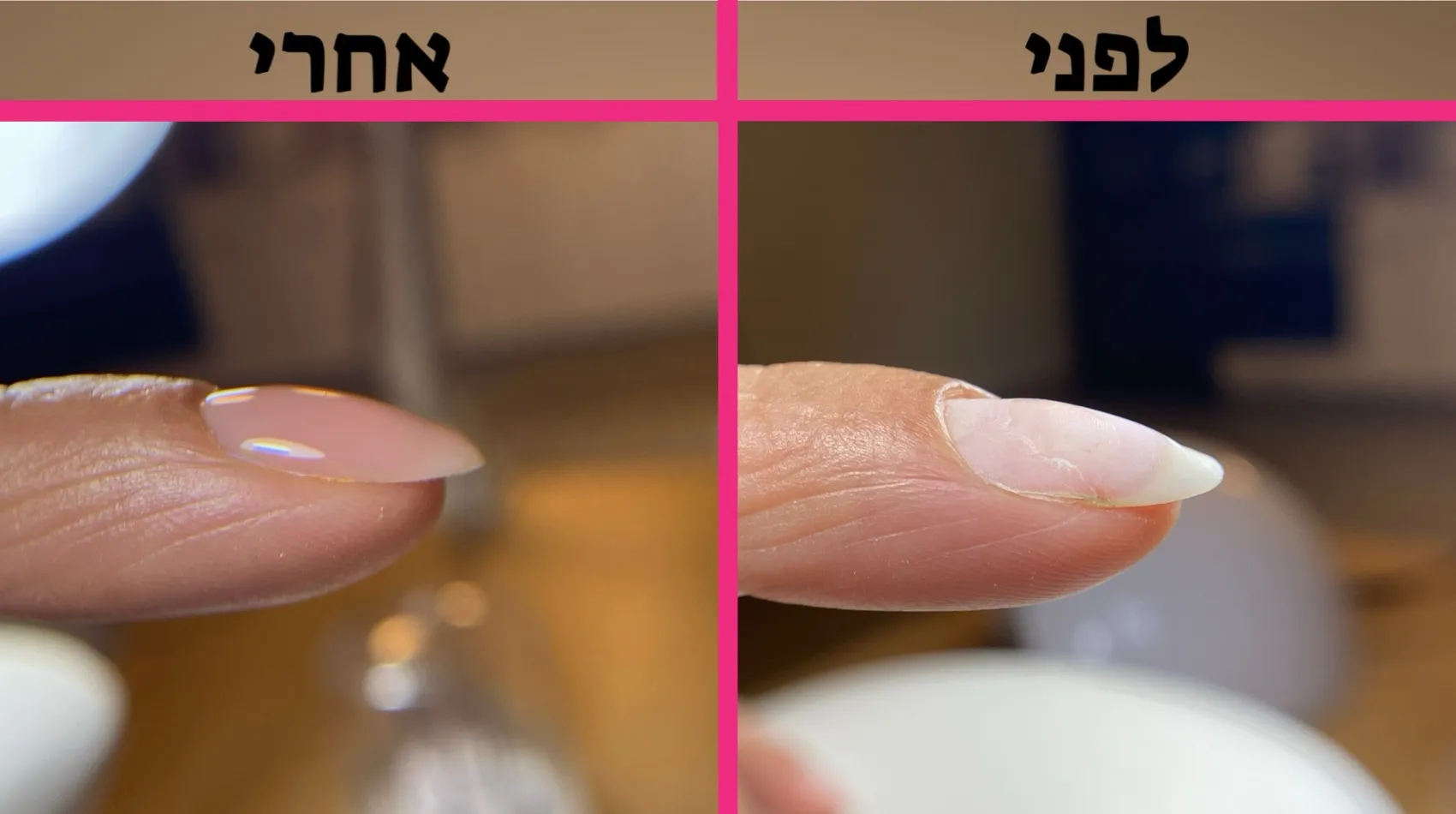 שתי מסגרות פרופיל של ציפורן, מסומנות בכיתוב לפני ואחרי